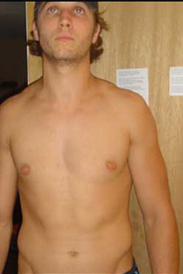james-k-before