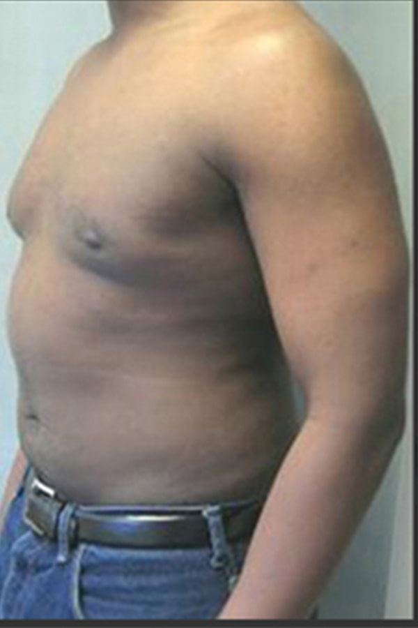chris-d-before