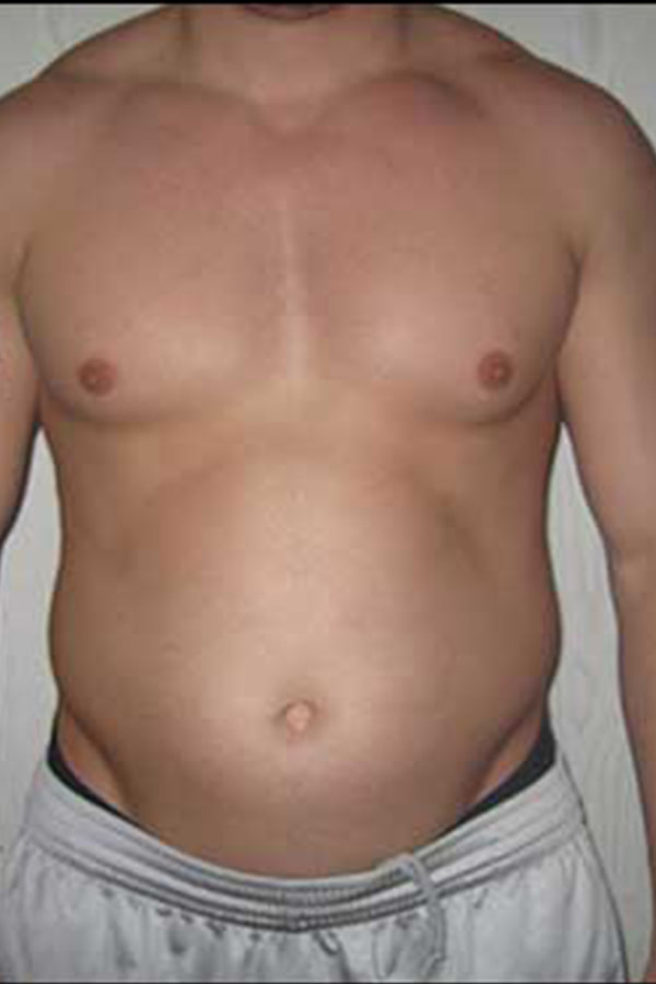 mike-m-before