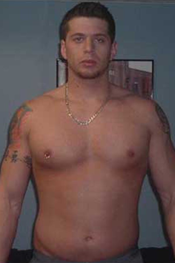 ryan1-before
