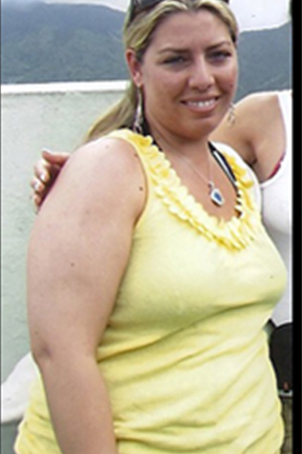 lorette-a-before
