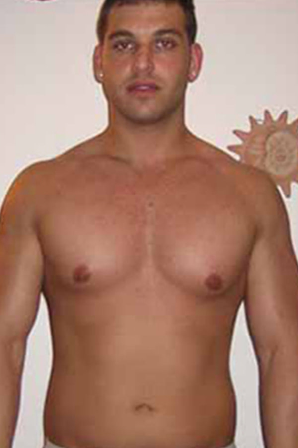 Chris-l-before