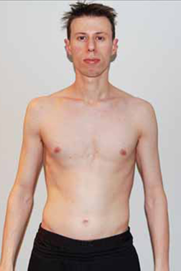 brian-before