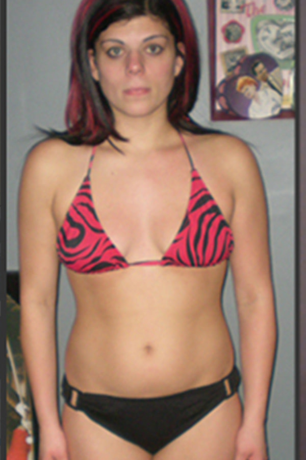 alicia-before